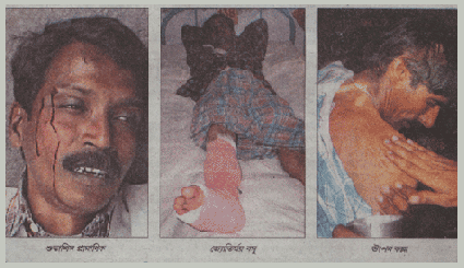 Journalists injured in lathicharge at Sheoraphuli
